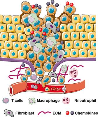 The Roles of Stroma-Derived Chemokine in Different Stages of Cancer Metastases